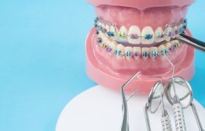 Ortho and braces treatment in dwarka