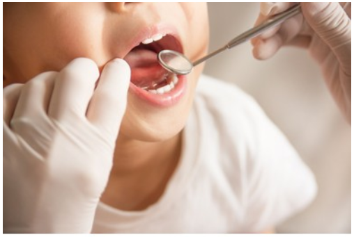 Tips From Pediatric Dentists to Prevent Cavities In Children