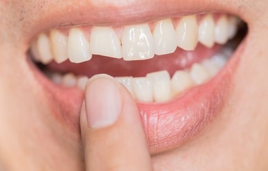 Oral Health, dental problem